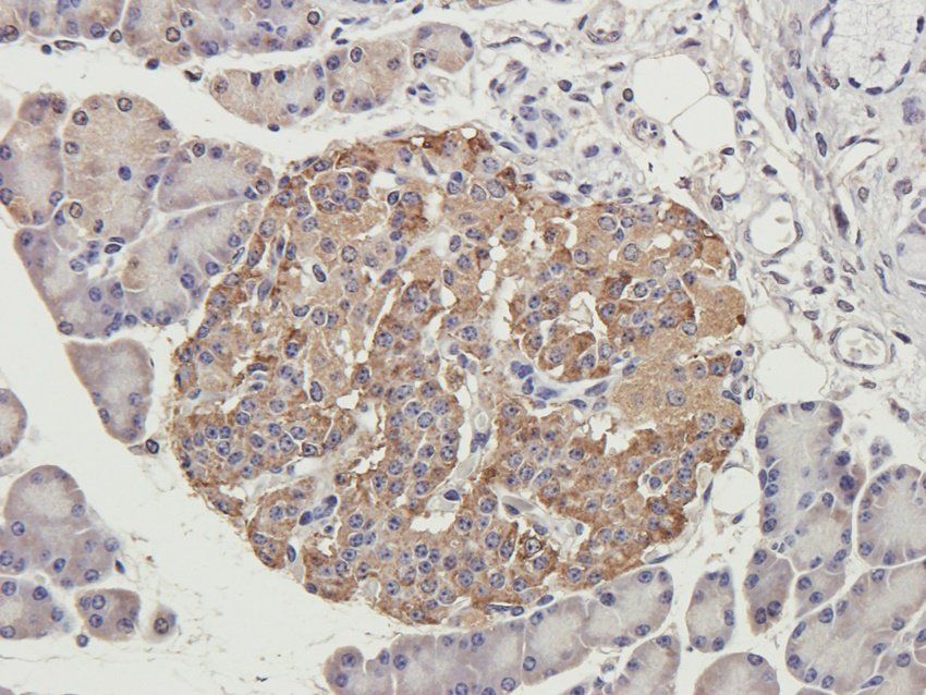 GMCSF antibody