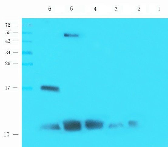 GMCSF antibody