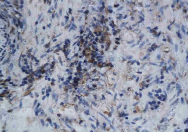 IL3RB Rabbit Polyclonal Antibody