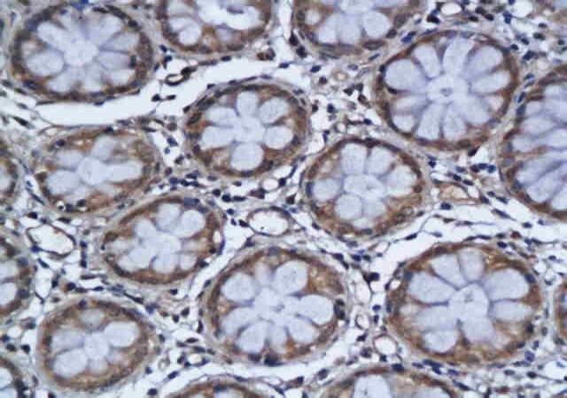 IL3RB Rabbit Polyclonal Antibody