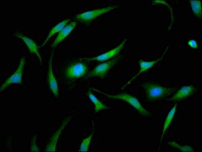 GMDS Antibody