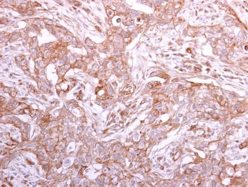 GMDS antibody [N2C3]