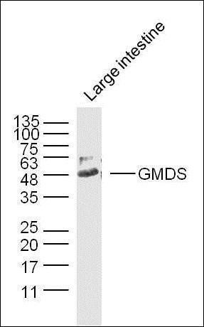 GMDS Rabbit Polyclonal Antibody
