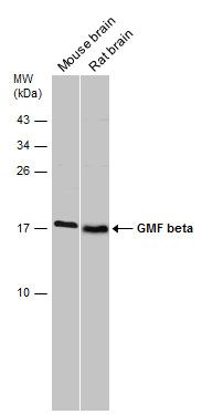 GMF beta antibody [N1C3]
