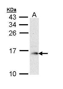 GMF beta antibody [N1C3]