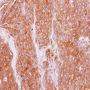 GMF-beta Rabbit Polyclonal Antibody