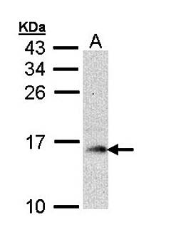 GMF-beta Rabbit Polyclonal Antibody