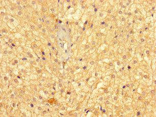 GMPPB Antibody