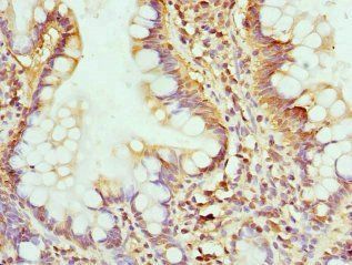 GMPS Antibody