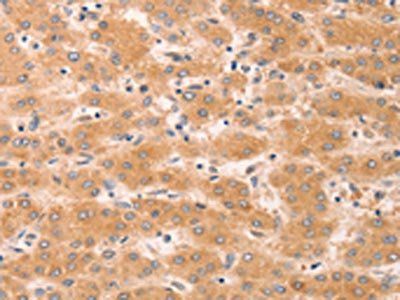 GNA11 Antibody