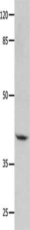 GNA11 Antibody