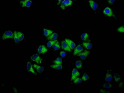 GNA12 Antibody