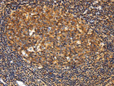 GNA13 Antibody