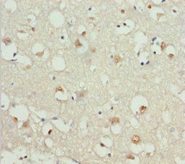 GNAO1 Antibody