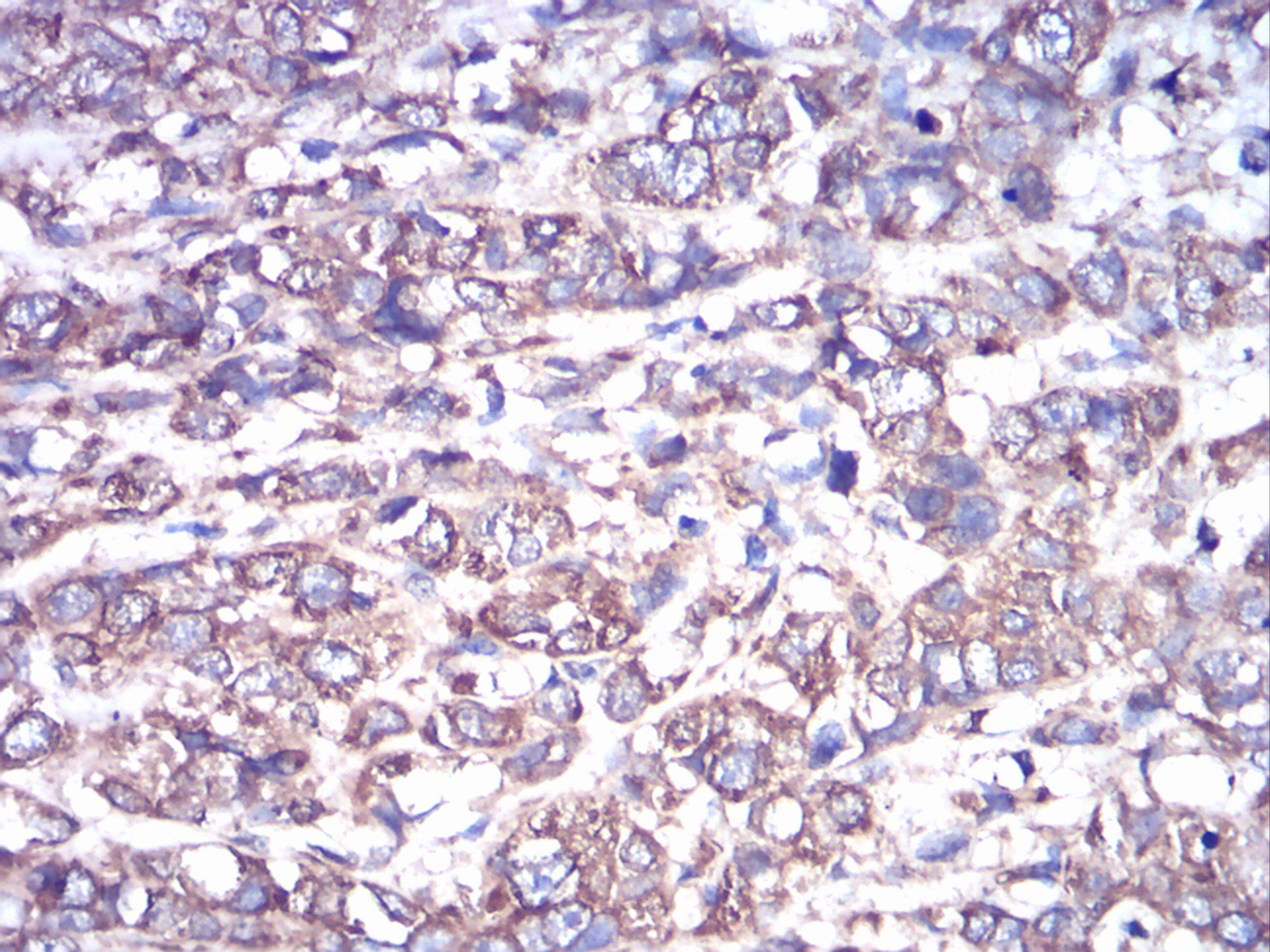 GNAS Antibody