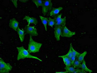 GNAT1 Antibody