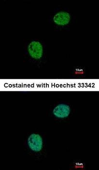 GNAT2 antibody