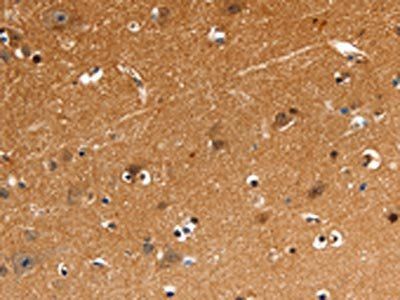 GNAZ Antibody