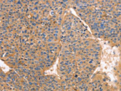 GNB1 antibody