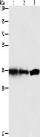 GNB1 antibody