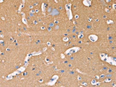 GNB1 Antibody
