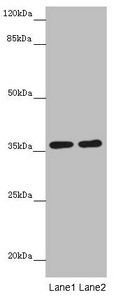 GNB1L Antibody