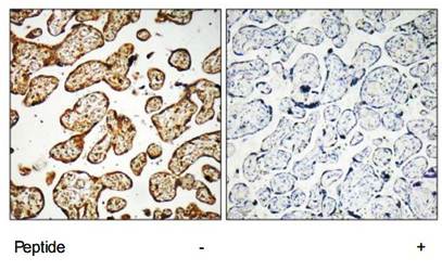 GNE antibody