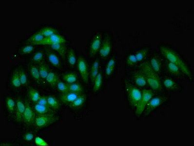 GNMT Antibody