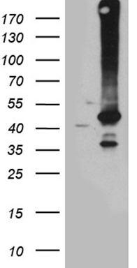 GNPAT Antibody