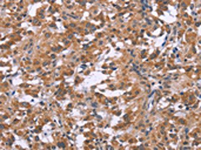 GNPAT Antibody
