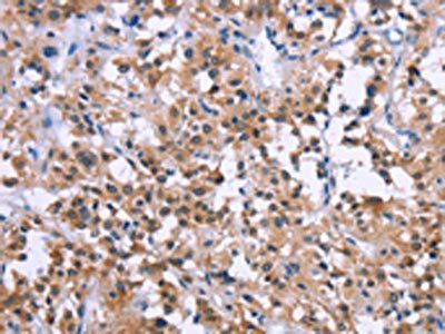 GNPAT Antibody