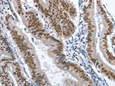 GNRH1 Antibody