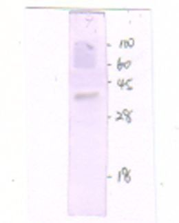 GnRH Receptor antibody