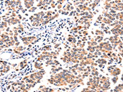GNRHR Antibody