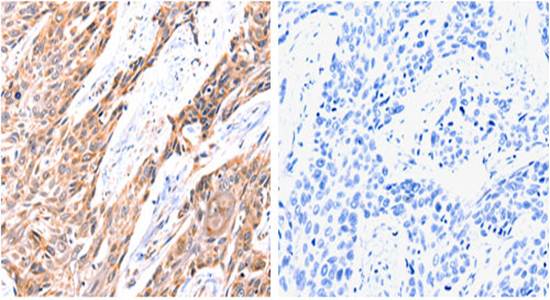 GNRHR Rabbit Polyclonal Antibody