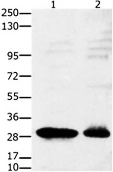 GNRHR Rabbit Polyclonal Antibody