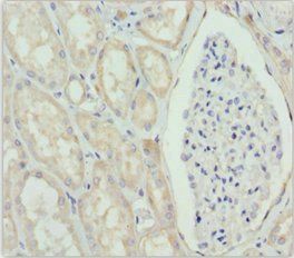 GNS Antibody