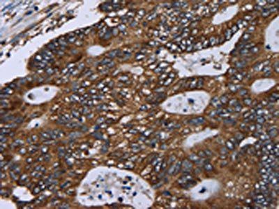 GOLGA2 Antibody