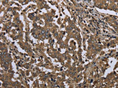 GOLGA2 Antibody