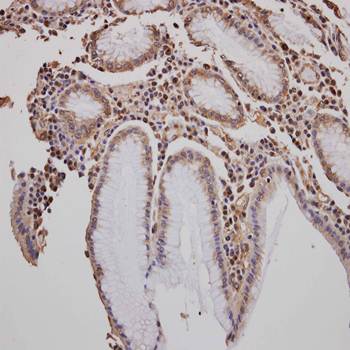 Golgi autoantigen, golgin subfamily a, 3 antibody