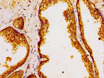 GOLPH3 Antibody