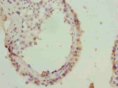 GOSR2 Antibody