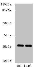 GOSR2 Antibody
