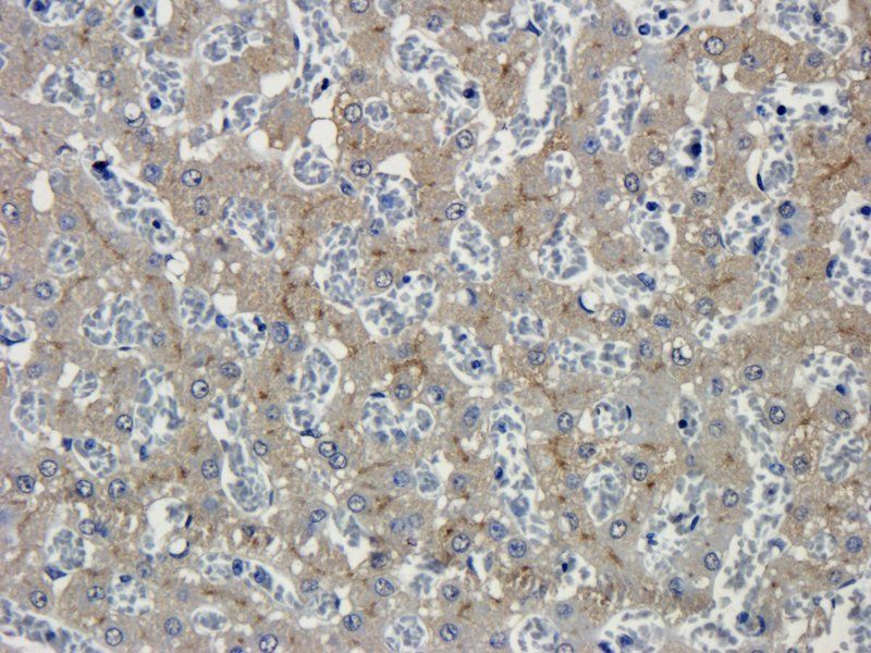 GP1BA antibody