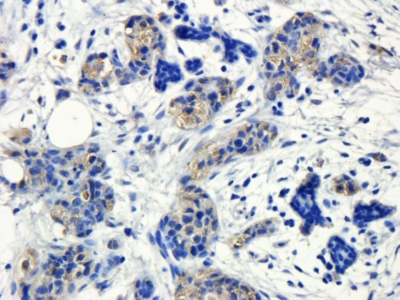 GP1BA antibody