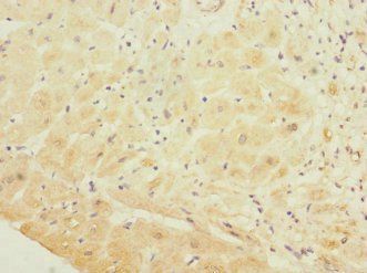 GP1BB Antibody