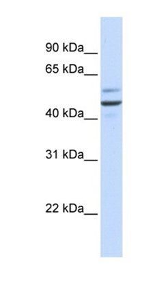 GP73 antibody