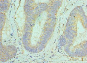 GOLM1 Antibody