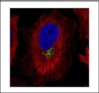 GP73 antibody