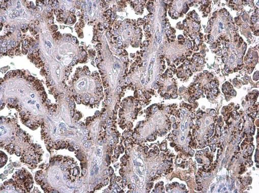 GOLPH2 antibody [C3], C-term